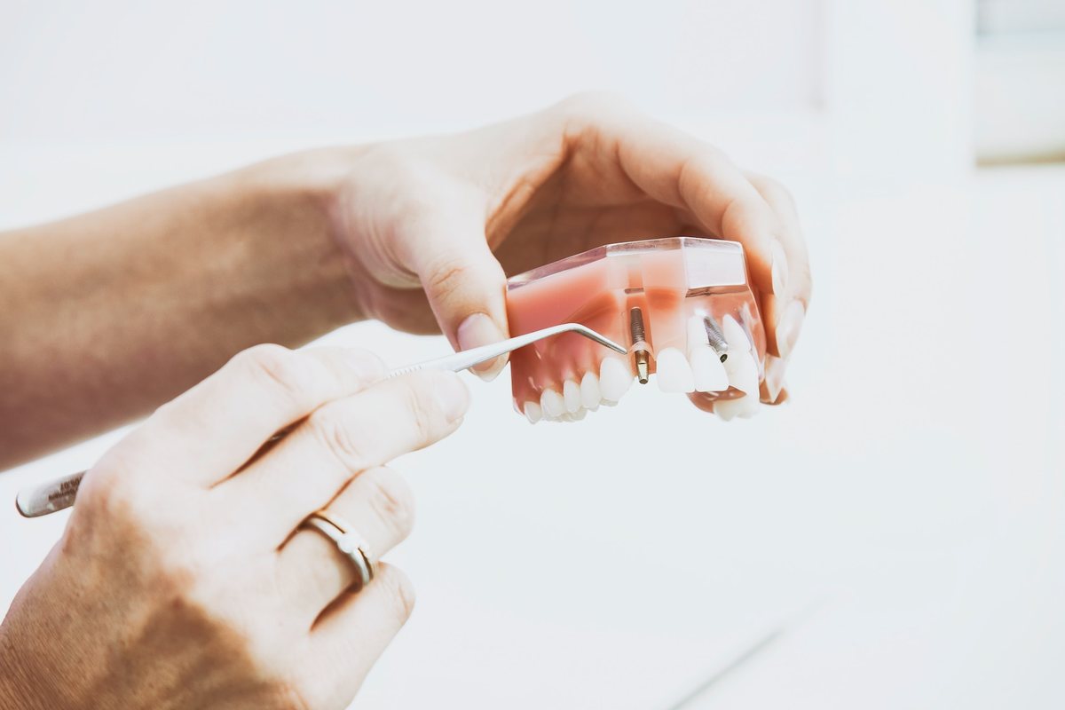 Dental implant model held in gloved hands